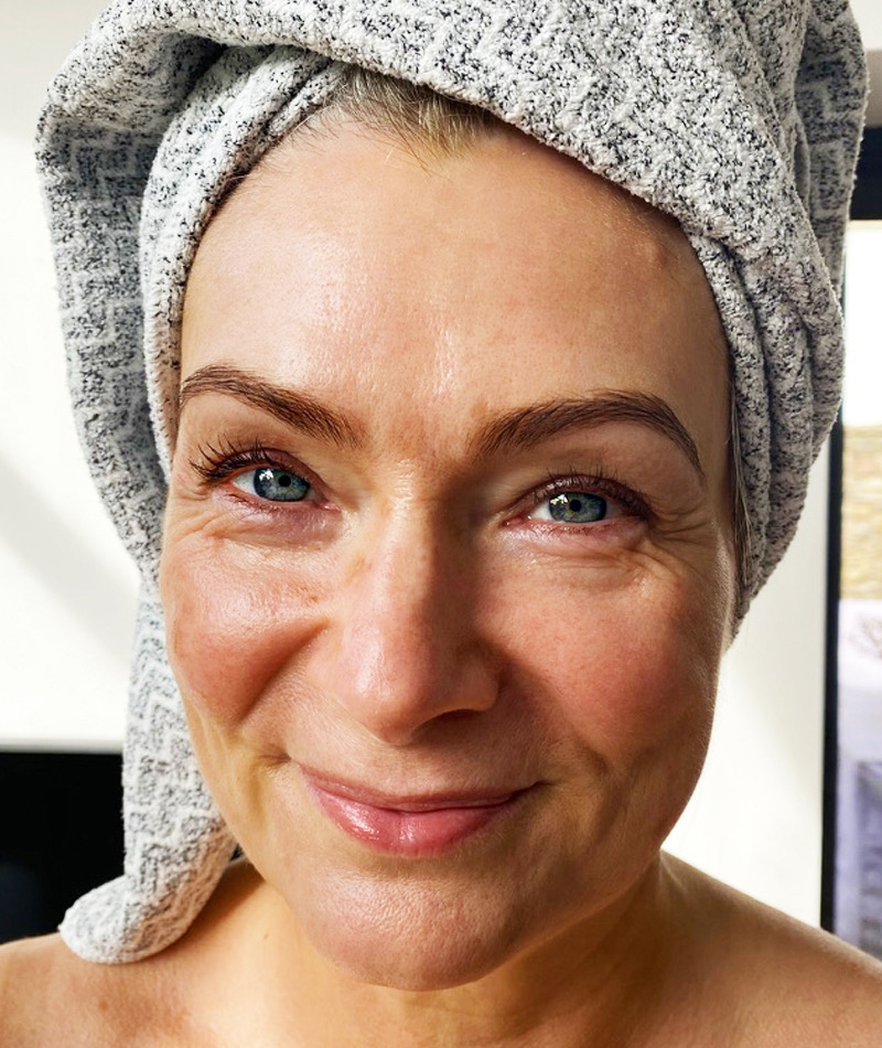 Kiehl's retinol before and after pictures