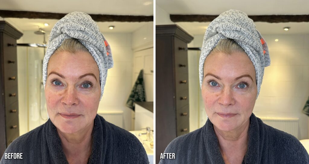 ZIIP Halo before and after Instant Lift, front